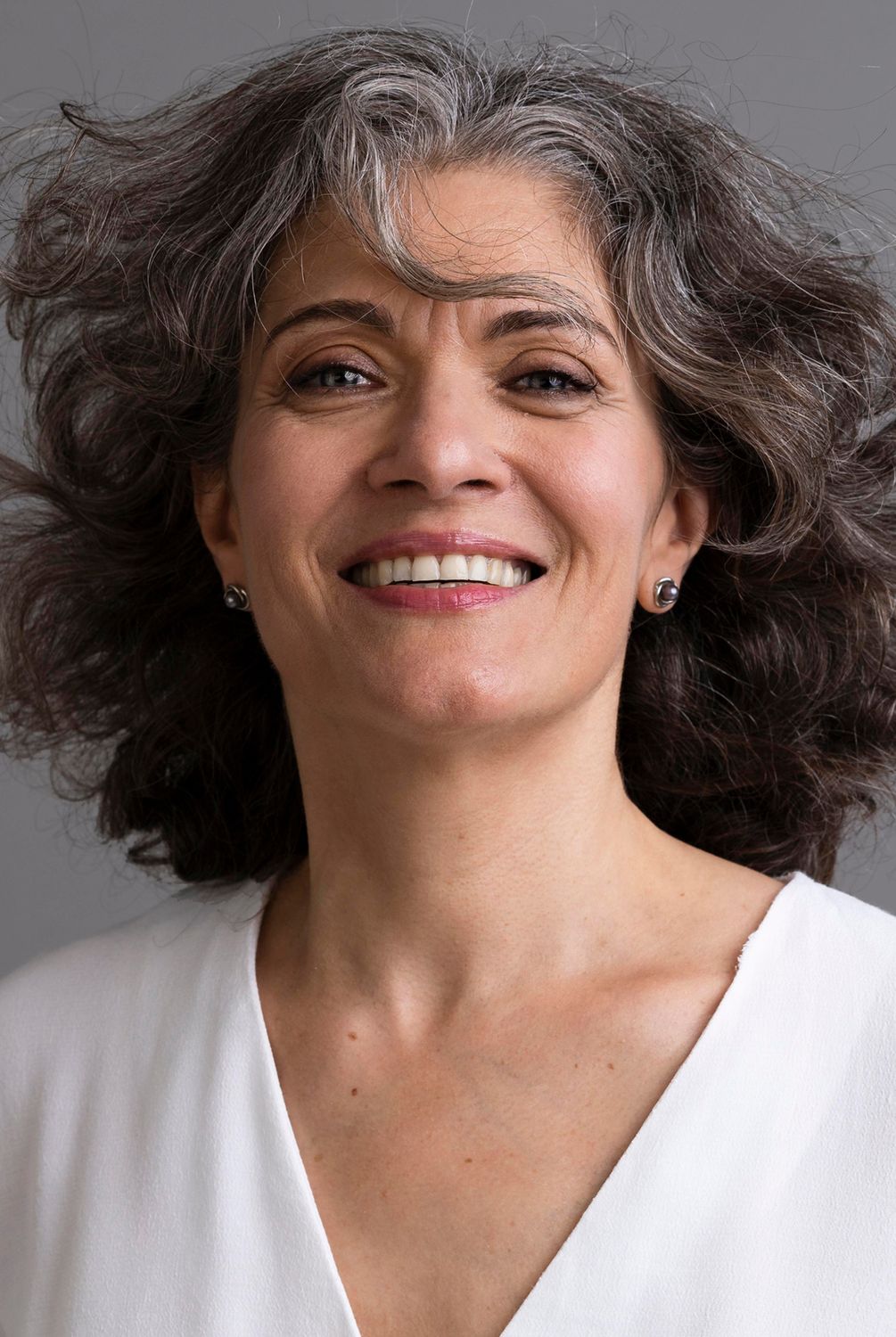 Alpharetta Bulkamid Injection model with curly gray hair.